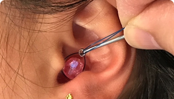 Close-up of a person’s ear with tweezers being used to remove a small, shiny pink object