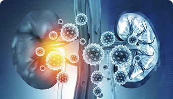 Digital illustration of human kidneys with virus-like particles surrounding them