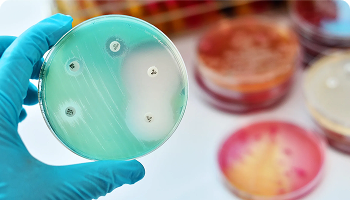 Petri dish with bacterial culture