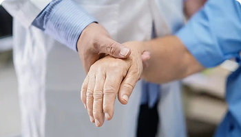 Doctor examining hand